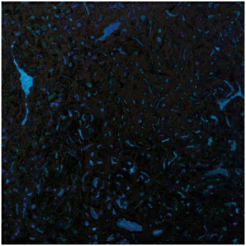 Zenker Brothers – Immersion [LP 001]